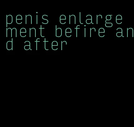 penis enlargement befire and after